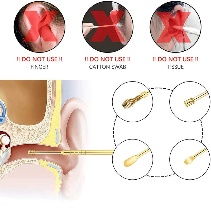 6 Pcs Ear Cleaner Tool Set